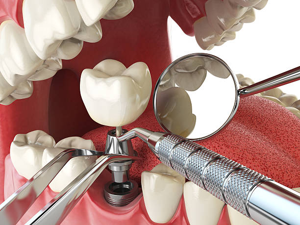 Best Emergency Treatment for Dental Infections or Abscesses in Hoer, OK